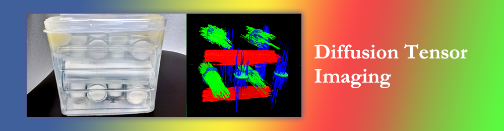 Diffusion Tensor Imaging