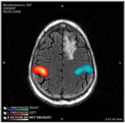 Japan Quantitative Imaging Biomarker Alliance (J-QIBA)